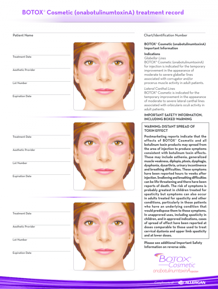 Allergan Botox Treatment Record - Fill Online, Printable, Fillable  - FREE Printables - Free Printable Botox Face Chart
