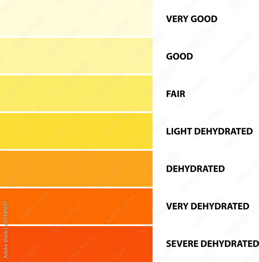 Stock-Vektorgrafik „Urine Color, Dehydration Urine Color Chart with Urine Color Chart Printable